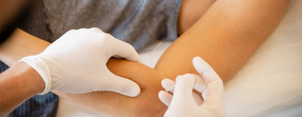 Demystifying Dry Needling: What Is It And How Does It Work?